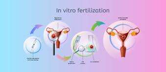 Best IVF Centres in Delhi With IVF Success Rates,